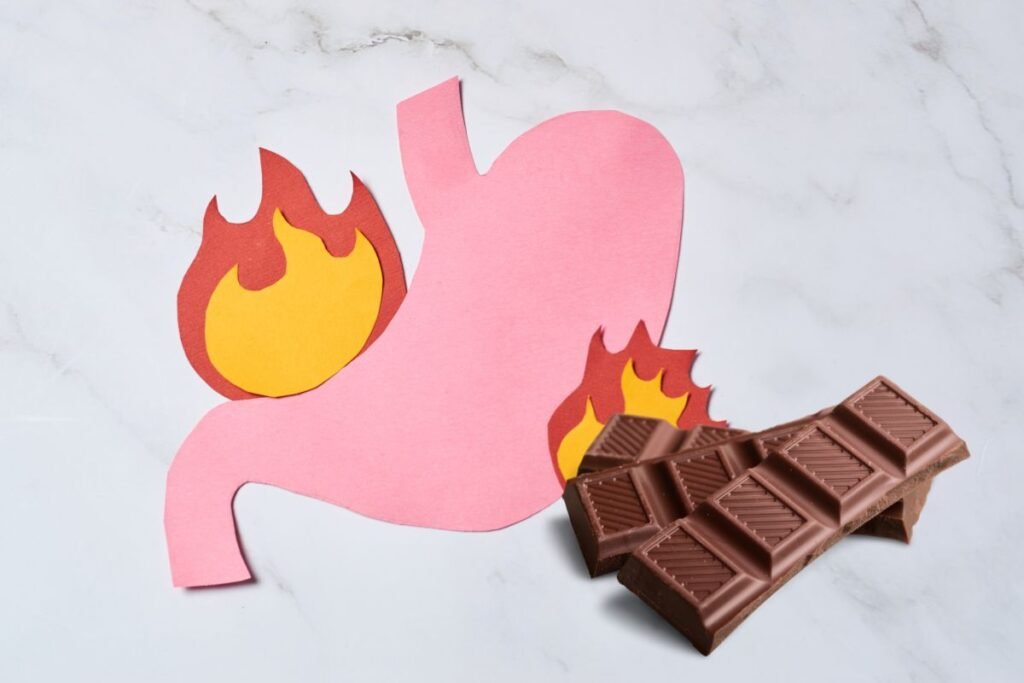 quem tem gastrite pode comer chocolate;