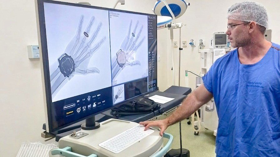 Hospitais de Fortaleza recebem novos equipamentos e ampliam oferta de cirurgias pelo SUS